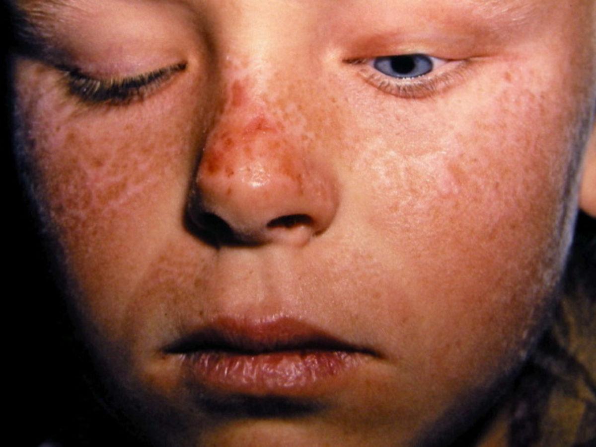 Vampirler ve Efsaneleri İçin Bilimsel Açıklama Geldi: Gerçekler!