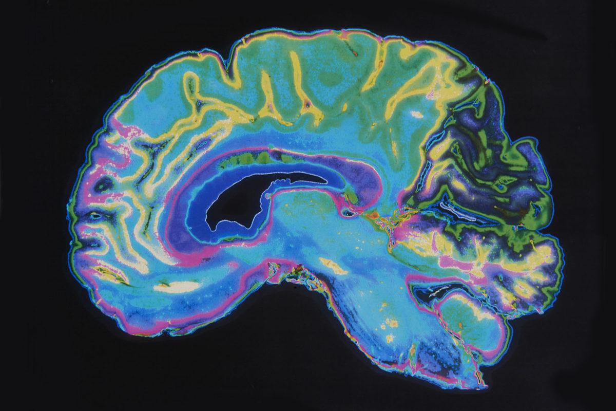 brain1