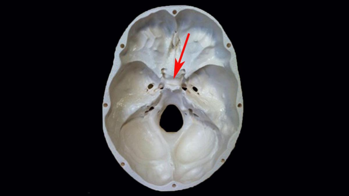 Kafatasımızda Bulunan ve İsmi Türklere İthafen Verilen Kemik: Sella Turcica