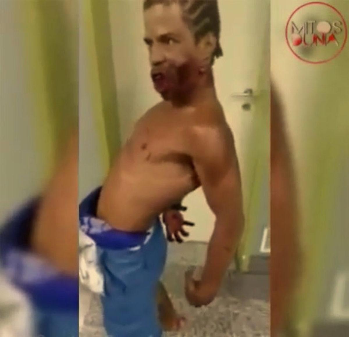 İnsanları Zombiye Dönüştüren Uyuşturucu Dünyaya Hızlıca Yayılıyor!