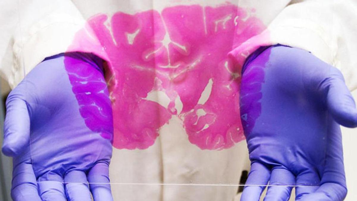 Beyninizi Daha İyi Çalıştırmanız İçin Yapmanız Gereken 10 Şey