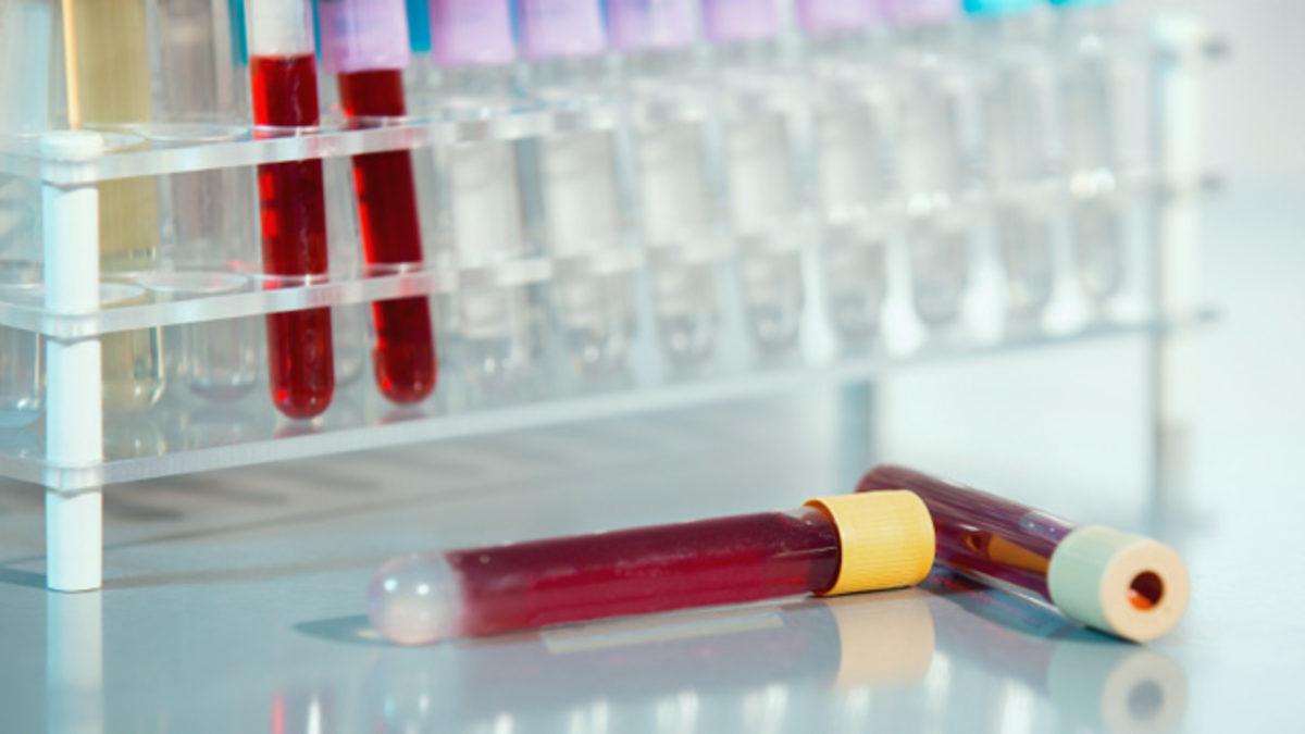 Aşırı Şeker Tüketiminin Vücuda ve Beyne Şok Edici Zararları!