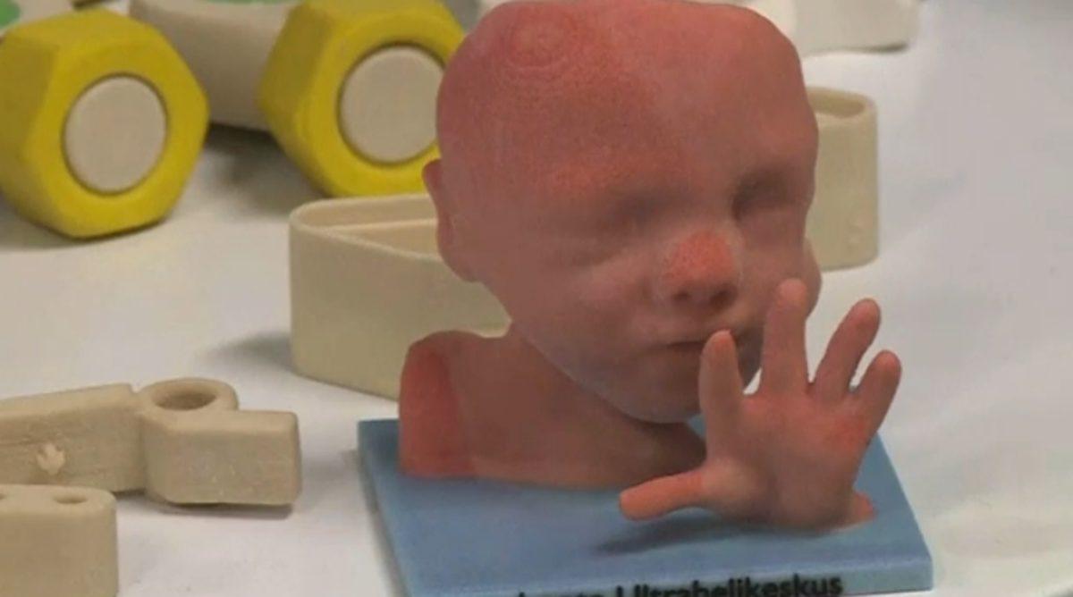 Doğmamış Bebeğin 3D Baskısını Çıkardılar