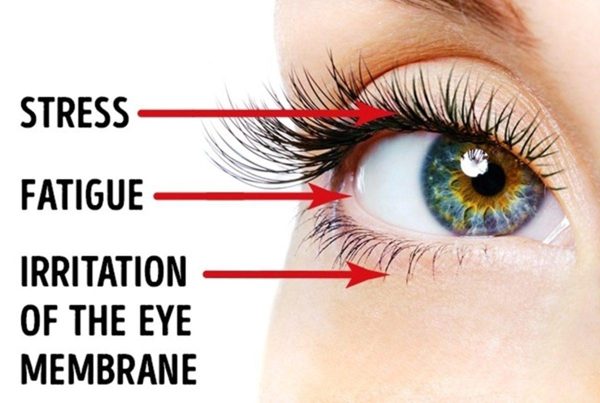 Göz Seğirmesini Durdurmanın 7 Kolay Yolu!