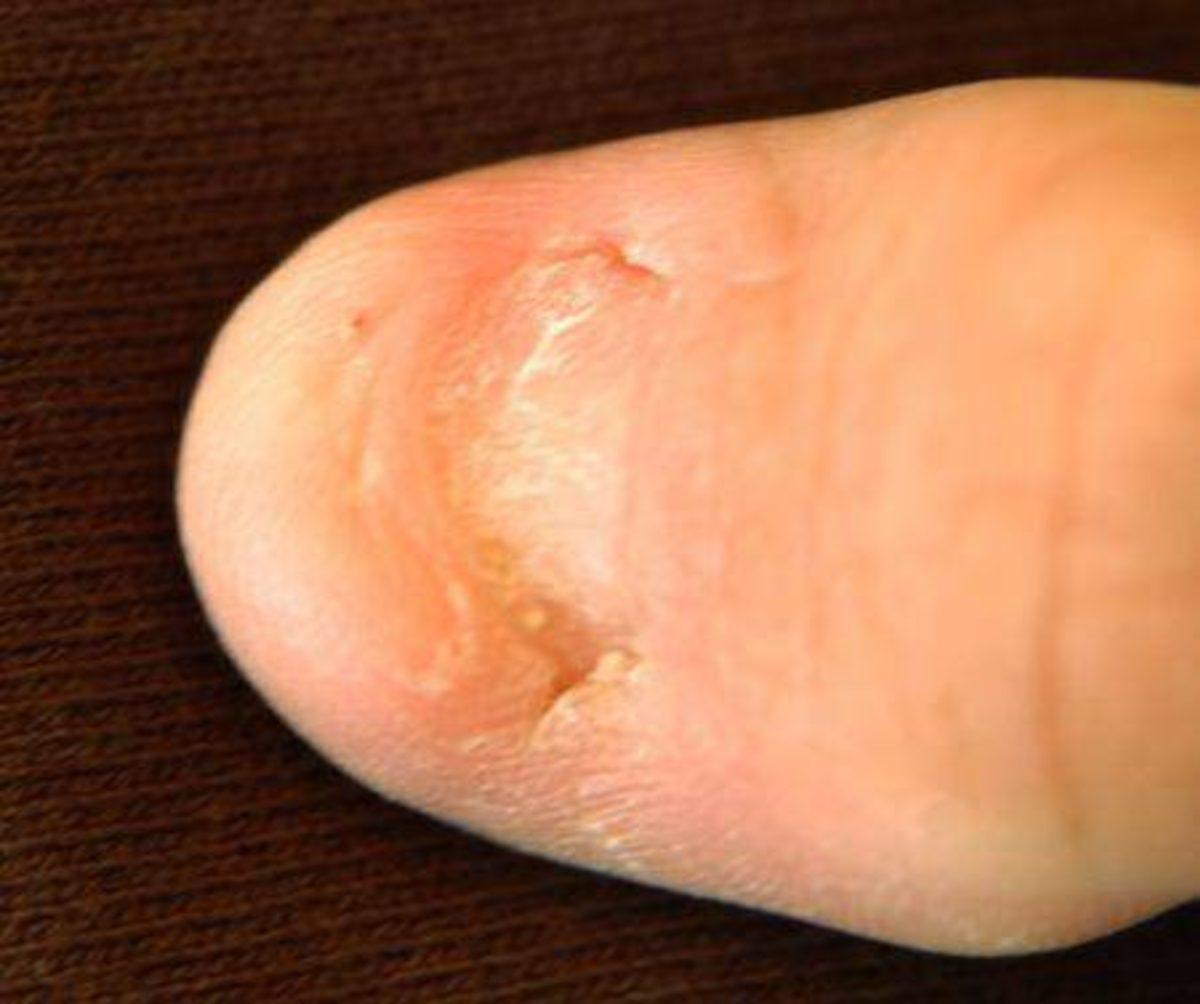 Akraba Evlilikleri Yüzünden Ortaya Çıkmış 10 Genetik Mutasyon!