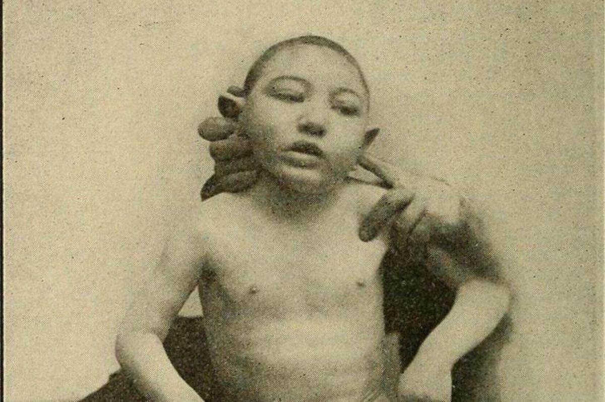 Akraba Evlilikleri Yüzünden Ortaya Çıkmış 10 Genetik Mutasyon!