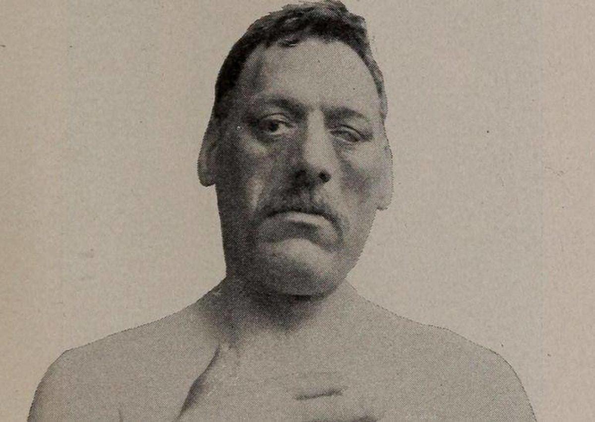 Akraba Evlilikleri Yüzünden Ortaya Çıkmış 10 Genetik Mutasyon!