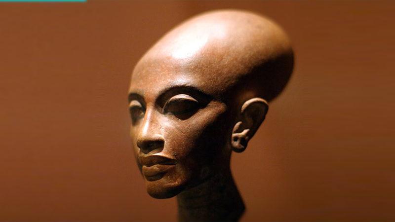 Akraba Evlilikleri Yüzünden Ortaya Çıkmış 10 Genetik Mutasyon!