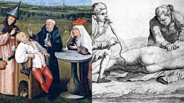 Hastalıktan Ölmeyi Tercih Edeceğiniz, Eski Çağlarda Denenmiş 7 Tedavi Yöntemi!