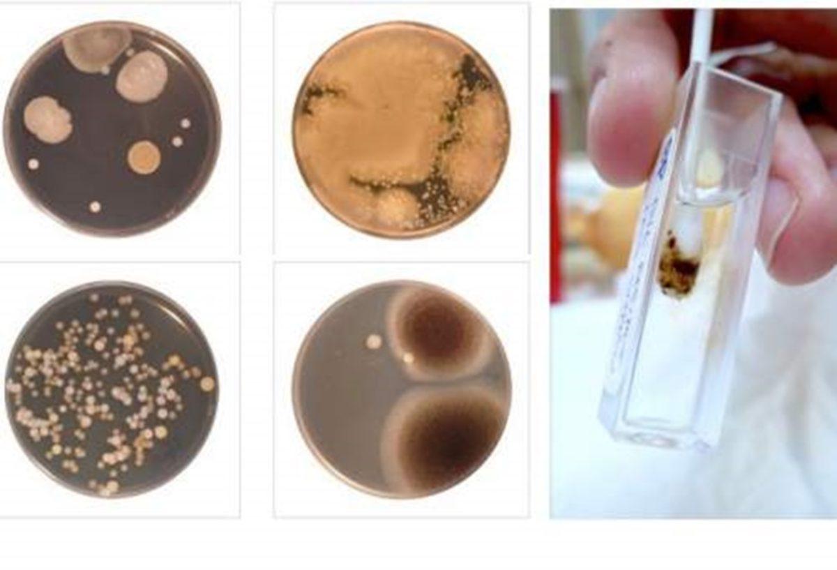 Vücudumuzun En Kirli Noktasının Neresi Olduğunu Biliyor muydunuz?