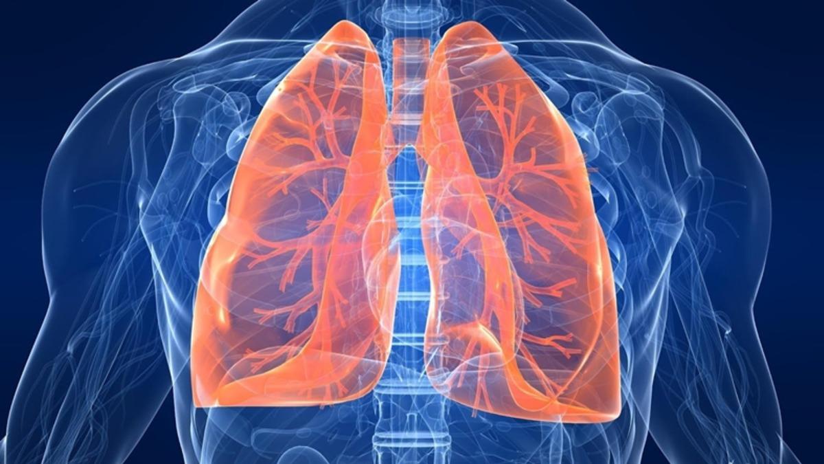 Ülkemizde İlk Kez Bir Kanser Hastasına Akciğer Nakli Yapıldı!