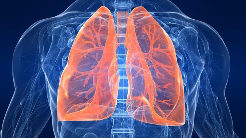 Ülkemizde İlk Kez Bir Kanser Hastasına Akciğer Nakli Yapıldı!