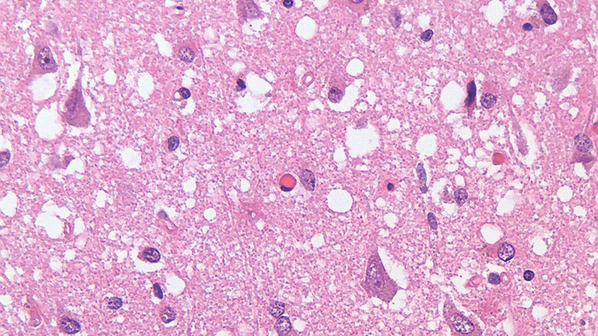 İnsan Eti Yemenin Potansiyel Sonuçlarını Öğrenince Çaresiz Olsanız Bile Aç Kalmayı Tercih Edeceksiniz