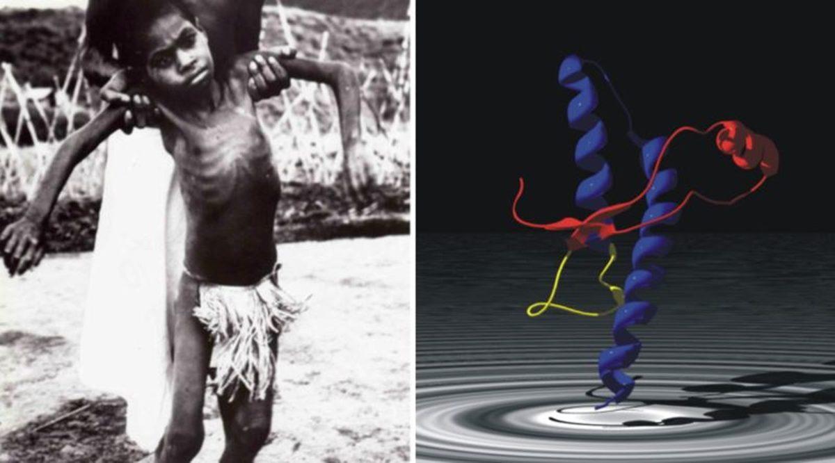 İnsan Eti Yemenin Potansiyel Sonuçlarını Öğrenince Çaresiz Olsanız Bile Aç Kalmayı Tercih Edeceksiniz