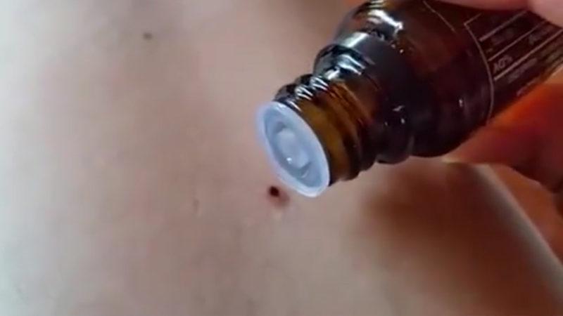 Vücuduna Yapışan Keneyi Sıra Dışı Bir Yolla Çıkaran Kadının Virale Dönen Videosu