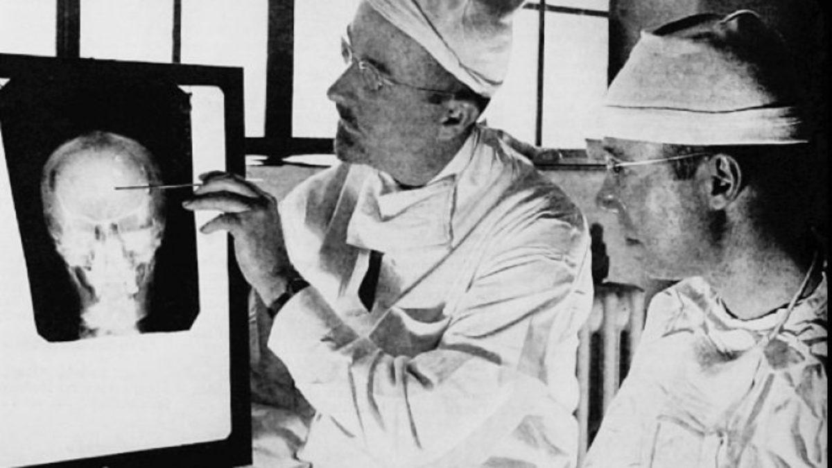 Yıllar Önce Tedavi Diye Kullanılmış 5 Kan Dondurucu Yöntem