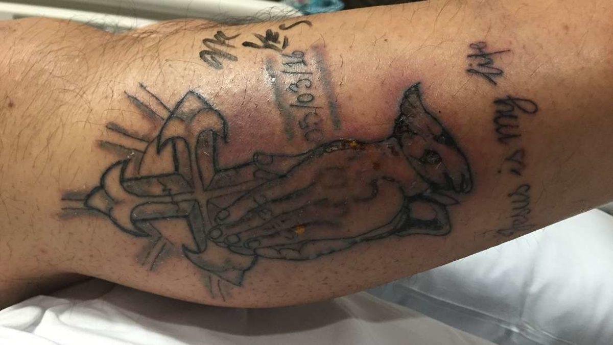 Dövme Yaptırdıktan Sonra Denize Giren Adam, ’Et Yiyen Bakteriler’ Nedeniyle Hayatını Kaybetti (+18)