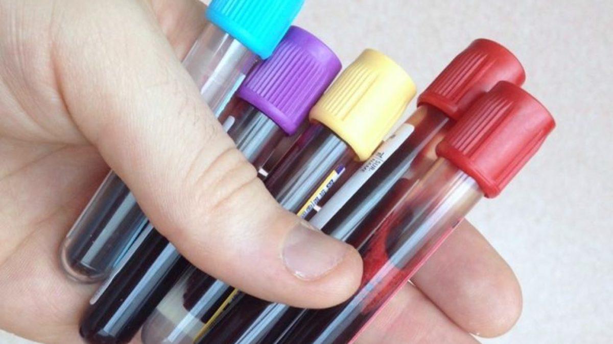 Bu Yeni Test Kanseri Çok Öncesinden Tespit Edebiliyor!
